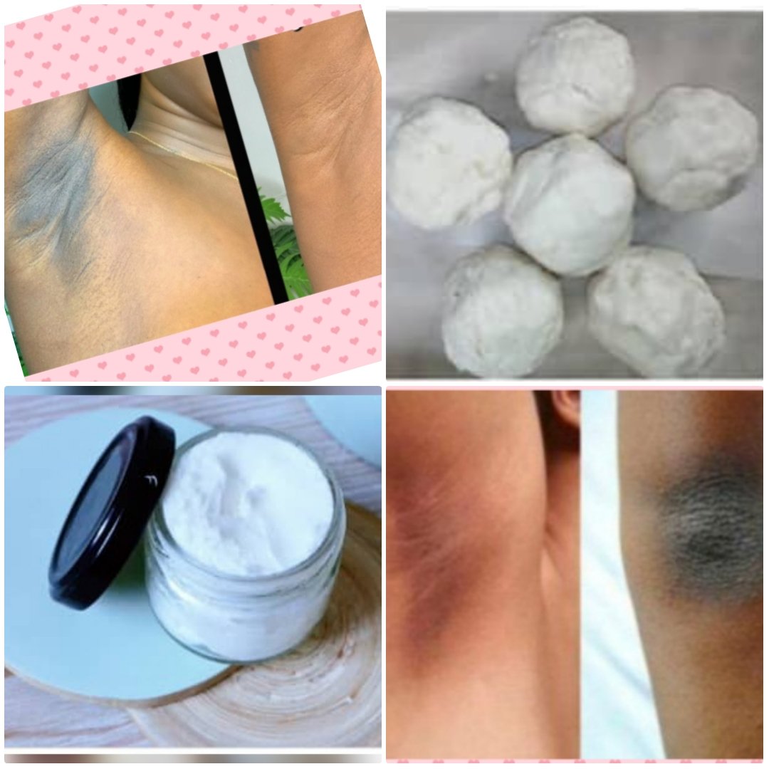 Kit savon crème pour parties sombres